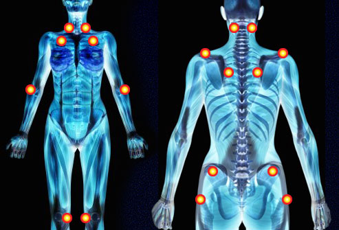 Fibromyalgia_images.jpg